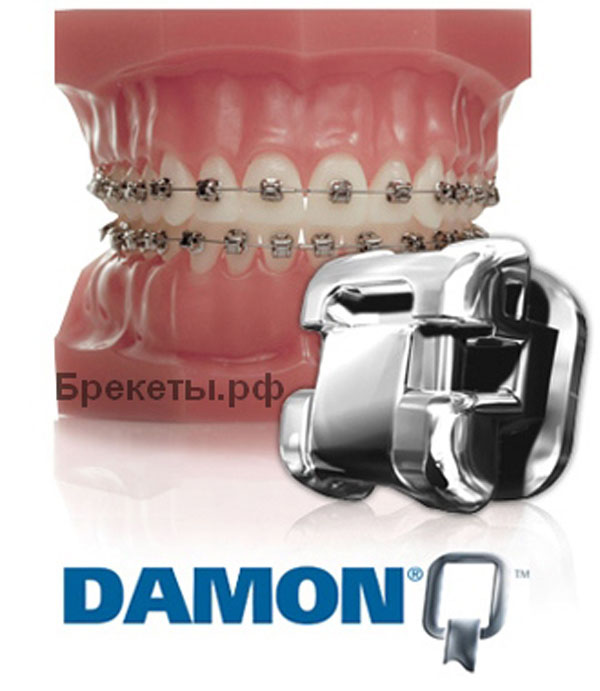 брекеты Damon Q