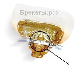 система incognito