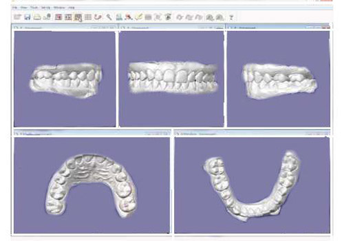 orthocad